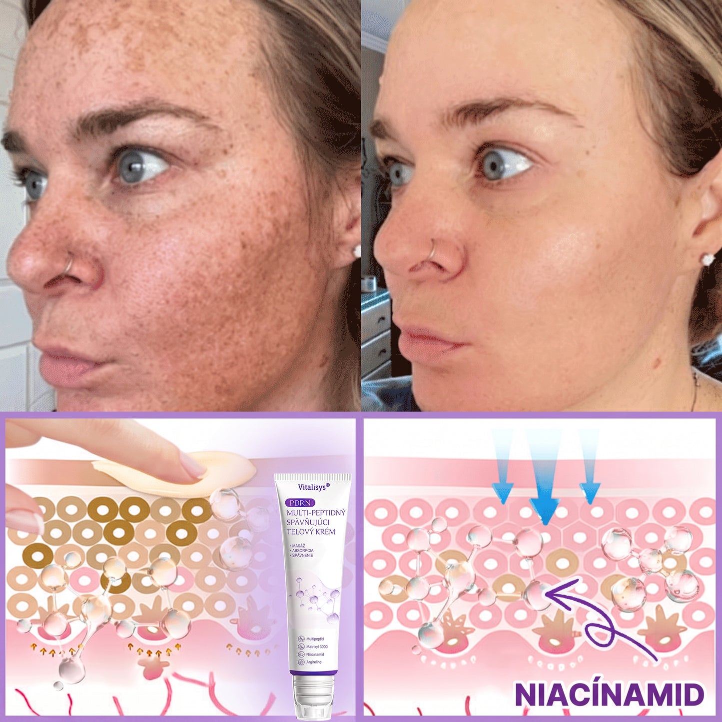 Vitalisys®❤️ PDRN Multi-Peptide Masážny telový krém s valčekom — proti starnutiu, hydratuje, spevňuje a nadvihuje pokožku, podporuje jej regeneráciu, zjednocuje tón pleti a pomáha zlepšiť vzhľad nedokonalostí a tmavých škvŕn.🍇