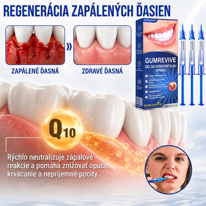 🇸🇰 𝑽𝒊𝒕𝒂𝒍𝒊𝒔𝒚𝒔®🦷 𝑮𝒖𝒎𝑹𝒆𝒗𝒊𝒗𝒆 𝑷𝒂𝒓𝒐𝒅𝒐𝒏𝒕á𝒍𝒏𝒚 𝑶𝒃𝒏𝒐𝒗𝒖𝒋ú𝒄𝒊 𝑮é𝒍🍊