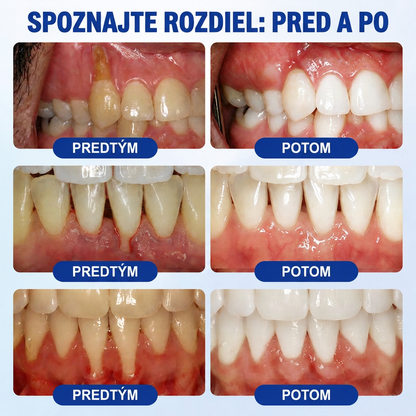 🇸🇰 𝑽𝒊𝒕𝒂𝒍𝒊𝒔𝒚𝒔®🦷 𝑮𝒖𝒎𝑹𝒆𝒗𝒊𝒗𝒆 𝑷𝒂𝒓𝒐𝒅𝒐𝒏𝒕á𝒍𝒏𝒚 𝑶𝒃𝒏𝒐𝒗𝒖𝒋ú𝒄𝒊 𝑮é𝒍🍊
