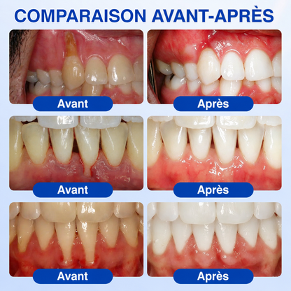 🇸🇰 𝑽𝒊𝒕𝒂𝒍𝒊𝒔𝒚𝒔®🦷 𝑮𝒖𝒎𝑹𝒆𝒗𝒊𝒗𝒆 𝑷𝒂𝒓𝒐𝒅𝒐𝒏𝒕á𝒍𝒏𝒚 𝑶𝒃𝒏𝒐𝒗𝒖𝒋ú𝒄𝒊 𝑮é𝒍❤️‍🔥
