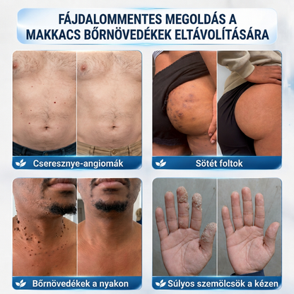 👩‍⚕️🎉 𝑶𝒇𝒇𝒊𝒛𝒊𝒆𝒍𝒍𝒆𝒓 𝑺𝒕𝒐𝒓𝒆 | 𝑵𝐞𝒌𝐢𝐬𝐬® 🎊 𝑴𝒊𝒌𝒓𝒐𝒏𝒂𝒅𝒆𝒍𝒏 𝑴𝒂𝒌𝒆𝒍𝒍𝒐𝒔𝒆 𝑯𝒂𝒖𝒕 𝑯𝒂𝒖𝒕 𝑾𝒂𝒓𝒛𝒆 𝑬𝒏𝒕𝒇𝒆𝒓𝒏𝒖𝒏𝒈 𝑷𝒇𝒍𝒂𝒔𝒕𝒆𝒓 (𝐹ü𝑟 𝐻𝑎𝑢𝑡𝑎𝑛ℎä𝑛𝑔𝑠𝑒𝑙, 𝑘𝑙𝑒𝑖𝑛𝑒 𝐻𝑎𝑢𝑡𝑤𝑢𝑐ℎ𝑒𝑟𝑢𝑛𝑔𝑒𝑛, 𝑊𝑎𝑟𝑧𝑒𝑛, 𝑀𝑢𝑡𝑡𝑒𝑟𝑚𝑎𝑙𝑒, 𝐴𝑙𝑡𝑒𝑟𝑠𝑓𝑙𝑒𝑐𝑘𝑒𝑛 𝑢𝑛𝑑 𝑃𝑖𝑔𝑚𝑒𝑛𝑡𝑠𝑡ö𝑟𝑢𝑛𝑔𝑒𝑛.)
