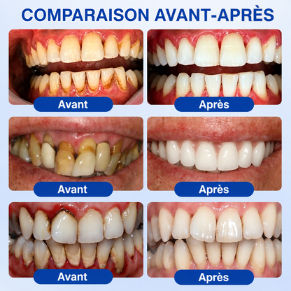 🇸🇰 𝑽𝒊𝒕𝒂𝒍𝒊𝒔𝒚𝒔®🦷 𝑮𝒖𝒎𝑹𝒆𝒗𝒊𝒗𝒆 𝑷𝒂𝒓𝒐𝒅𝒐𝒏𝒕á𝒍𝒏𝒚 𝑶𝒃𝒏𝒐𝒗𝒖𝒋ú𝒄𝒊 𝑮é𝒍❤️‍🔥