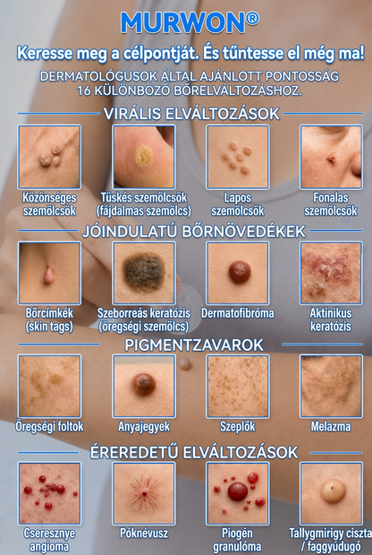 👩‍⚕️🎉 𝑶𝒇𝒇𝒊𝒛𝒊𝒆𝒍𝒍𝒆𝒓 𝑺𝒕𝒐𝒓𝒆 | 𝑵𝐞𝒌𝐢𝐬𝐬® 🎊 𝑴𝒊𝒌𝒓𝒐𝒏𝒂𝒅𝒆𝒍𝒏 𝑴𝒂𝒌𝒆𝒍𝒍𝒐𝒔𝒆 𝑯𝒂𝒖𝒕 𝑯𝒂𝒖𝒕 𝑾𝒂𝒓𝒛𝒆 𝑬𝒏𝒕𝒇𝒆𝒓𝒏𝒖𝒏𝒈 𝑷𝒇𝒍𝒂𝒔𝒕𝒆𝒓 (𝐹ü𝑟 𝐻𝑎𝑢𝑡𝑎𝑛ℎä𝑛𝑔𝑠𝑒𝑙, 𝑘𝑙𝑒𝑖𝑛𝑒 𝐻𝑎𝑢𝑡𝑤𝑢𝑐ℎ𝑒𝑟𝑢𝑛𝑔𝑒𝑛, 𝑊𝑎𝑟𝑧𝑒𝑛, 𝑀𝑢𝑡𝑡𝑒𝑟𝑚𝑎𝑙𝑒, 𝐴𝑙𝑡𝑒𝑟𝑠𝑓𝑙𝑒𝑐𝑘𝑒𝑛 𝑢𝑛𝑑 𝑃𝑖𝑔𝑚𝑒𝑛𝑡𝑠𝑡ö𝑟𝑢𝑛𝑔𝑒𝑛.)