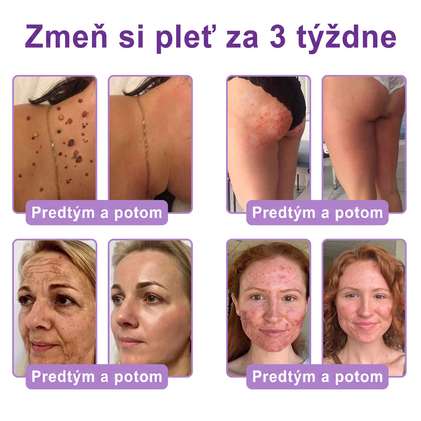 Vitalisys®❤️ PDRN Multi-Peptide Masážny telový krém s valčekom — proti starnutiu, hydratuje, spevňuje a nadvihuje pokožku, podporuje jej regeneráciu, zjednocuje tón pleti a pomáha zlepšiť vzhľad nedokonalostí a tmavých škvŕn.🍇