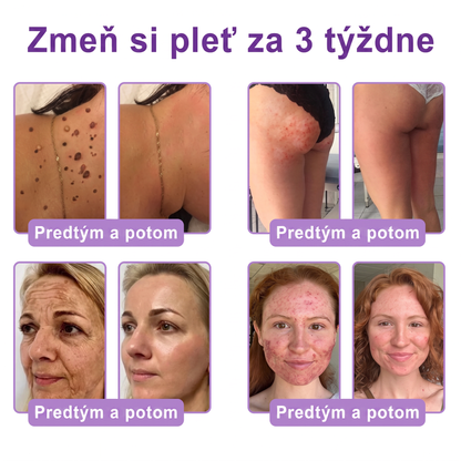 Vitalisys®❤️ PDRN Multi-Peptide Masážny telový krém s valčekom — proti starnutiu, hydratuje, spevňuje a nadvihuje pokožku, podporuje jej regeneráciu, zjednocuje tón pleti a pomáha zlepšiť vzhľad nedokonalostí a tmavých škvŕn.🍇