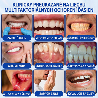 🇸🇰 𝑽𝒊𝒕𝒂𝒍𝒊𝒔𝒚𝒔®🦷 𝑮𝒖𝒎𝑹𝒆𝒗𝒊𝒗𝒆 𝑷𝒂𝒓𝒐𝒅𝒐𝒏𝒕á𝒍𝒏𝒚 𝑶𝒃𝒏𝒐𝒗𝒖𝒋ú𝒄𝒊 𝑮é𝒍🍊