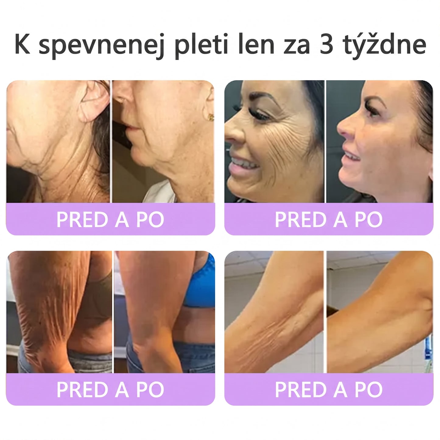 Vitalisys®❤️ PDRN Multi-Peptide Masážny telový krém s valčekom — proti starnutiu, hydratuje, spevňuje a nadvihuje pokožku, podporuje jej regeneráciu, zjednocuje tón pleti a pomáha zlepšiť vzhľad nedokonalostí a tmavých škvŕn.🍇