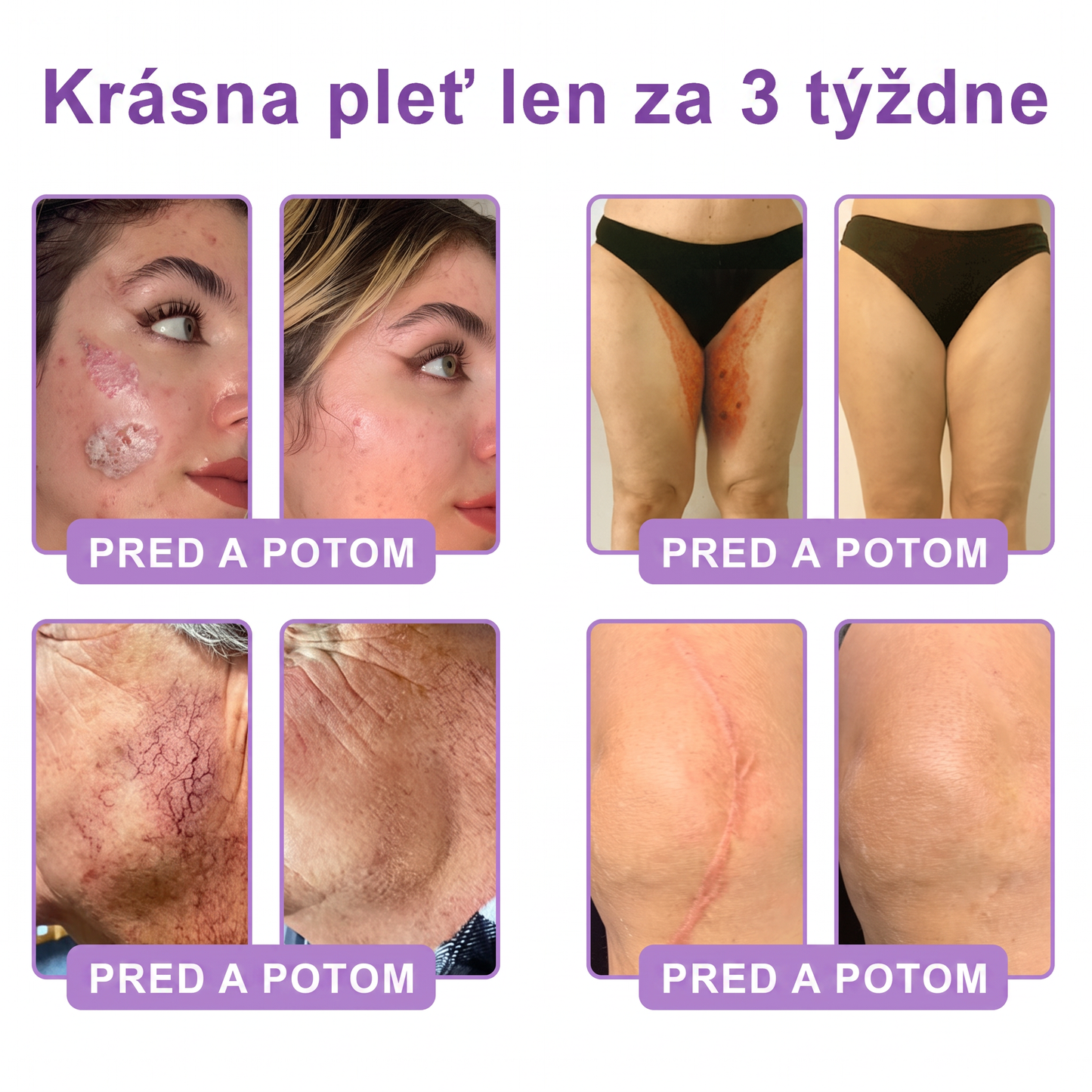 Vitalisys®❤️ PDRN Multi-Peptide Masážny telový krém s valčekom — proti starnutiu, hydratuje, spevňuje a nadvihuje pokožku, podporuje jej regeneráciu, zjednocuje tón pleti a pomáha zlepšiť vzhľad nedokonalostí a tmavých škvŕn.🍇