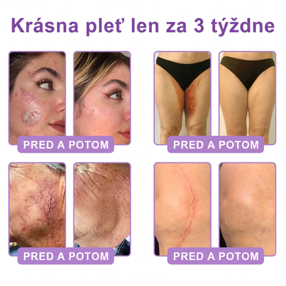 Vitalisys®❤️ PDRN Multi-Peptide Masážny telový krém s valčekom — proti starnutiu, hydratuje, spevňuje a nadvihuje pokožku, podporuje jej regeneráciu, zjednocuje tón pleti a pomáha zlepšiť vzhľad nedokonalostí a tmavých škvŕn.🍇