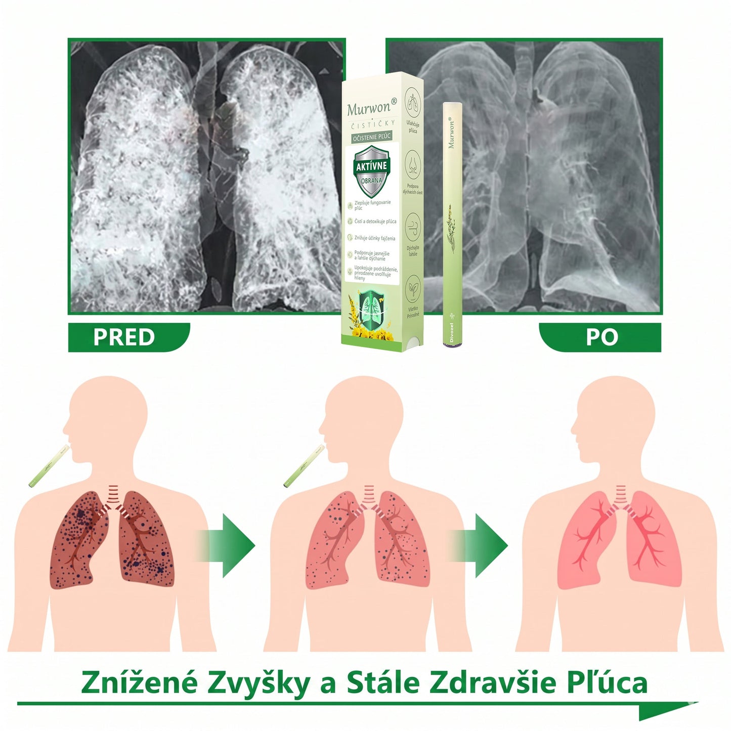 🇸🇰 Vysoko kvalitný slovenský výrobok s doručením v rámci krajiny 🏠 Murwon® bylinný inhalátor na čistenie pľúc 🍏 (👨‍⚕️ Účinná pomoc: kašeľ, zápal hrtana, krátenie dychu, hlieny, ucpaný nos, bronchitída, alergické príznaky a pľúcne ťažkosti) ❤️