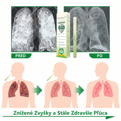 🇸🇰 Vysoko kvalitný slovenský výrobok s doručením v rámci krajiny 🏠 Murwon® bylinný inhalátor na čistenie pľúc 🍏 (👨‍⚕️ Účinná pomoc: kašeľ, zápal hrtana, krátenie dychu, hlieny, ucpaný nos, bronchitída, alergické príznaky a pľúcne ťažkosti) ❤️