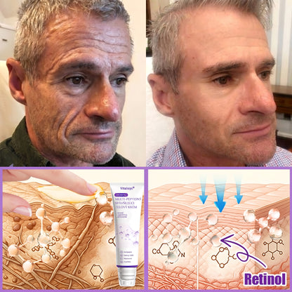 Vitalisys®❤️ PDRN Multi-Peptide Masážny telový krém s valčekom — proti starnutiu, hydratuje, spevňuje a nadvihuje pokožku, podporuje jej regeneráciu, zjednocuje tón pleti a pomáha zlepšiť vzhľad nedokonalostí a tmavých škvŕn.🍇