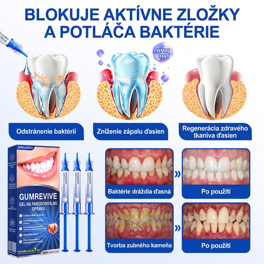 🇸🇰 𝑽𝒊𝒕𝒂𝒍𝒊𝒔𝒚𝒔®🦷 𝑮𝒖𝒎𝑹𝒆𝒗𝒊𝒗𝒆 𝑷𝒂𝒓𝒐𝒅𝒐𝒏𝒕á𝒍𝒏𝒚 𝑶𝒃𝒏𝒐𝒗𝒖𝒋ú𝒄𝒊 𝑮é𝒍🍊