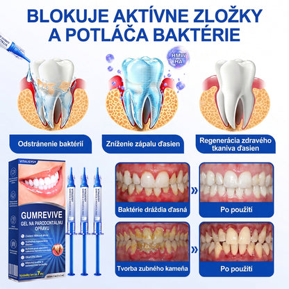 🇸🇰 𝑽𝒊𝒕𝒂𝒍𝒊𝒔𝒚𝒔®🦷 𝑮𝒖𝒎𝑹𝒆𝒗𝒊𝒗𝒆 𝑷𝒂𝒓𝒐𝒅𝒐𝒏𝒕á𝒍𝒏𝒚 𝑶𝒃𝒏𝒐𝒗𝒖𝒋ú𝒄𝒊 𝑮é𝒍🍊