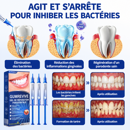 🇸🇰 𝑽𝒊𝒕𝒂𝒍𝒊𝒔𝒚𝒔®🦷 𝑮𝒖𝒎𝑹𝒆𝒗𝒊𝒗𝒆 𝑷𝒂𝒓𝒐𝒅𝒐𝒏𝒕á𝒍𝒏𝒚 𝑶𝒃𝒏𝒐𝒗𝒖𝒋ú𝒄𝒊 𝑮é𝒍❤️‍🔥